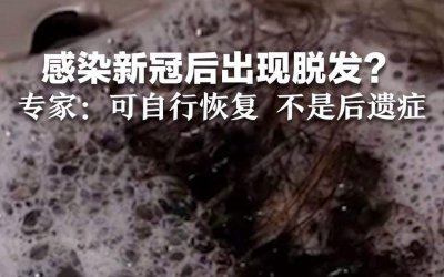 ​专家说感染新冠后脱发比较普遍（感染新冠会脱发严重吗）