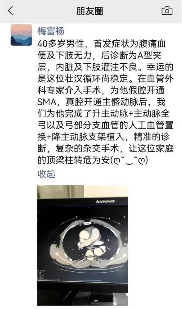 男子出汗后猛吹空调诱发主动脉夹层