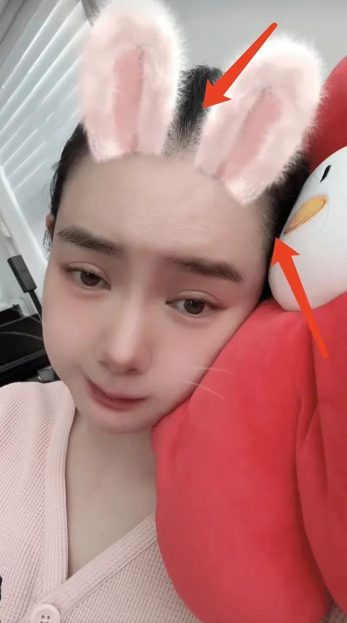 戚薇新剧无滤镜！被吐槽皮肤黑糙！戚薇开滤镜恢复少女颜调侃自己
