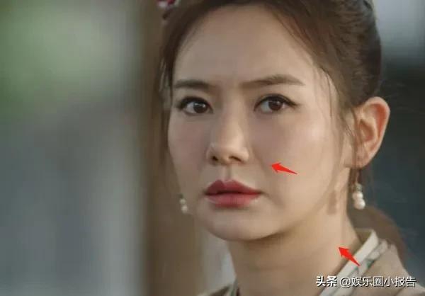 戚薇新剧不再磨皮修图，显示真实皮肤状态，让很多装嫩女演员难堪