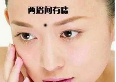 ​克夫痣 哪里长痣会克夫