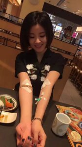 ​捅马蜂窝的女孩（手臂被捅成了“马蜂窝”的姑娘红了，她说最喜欢呆萌老实的“