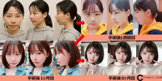 经历类似Angelababy的深田咏美写真分享，日推女王！