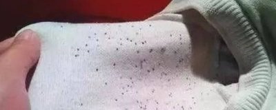 ​衣服上出现很多小黑点 衣服上有小黑点是什么情况