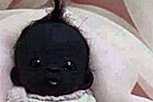 十大世界上最黑的小孩有多黑（眼睛整个都是黑色的）  1
