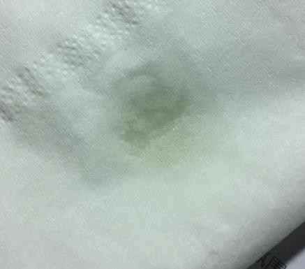 天竺葵精油可以去黑头吗？天竺葵精油怎么去黑头