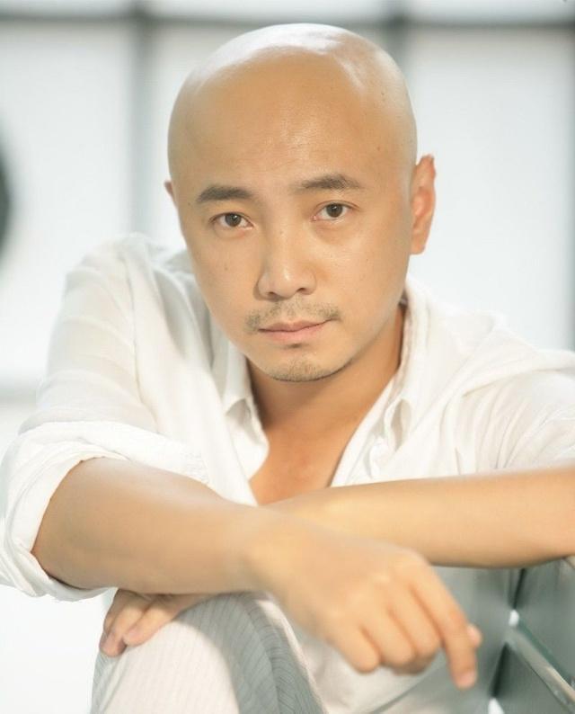 陈赫晒发际线, 笑称两个月后秃顶指日可待