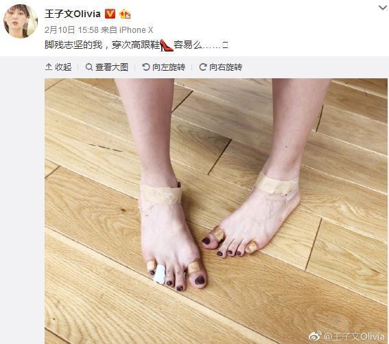景甜浴室晒照，不仅暴露身材被张继科嫌弃，脚趾造型更是奇特