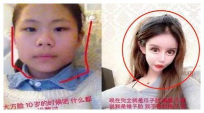 ​“网红失败整容照”大盘点，前后对比超惨烈，网友：根本没眼看