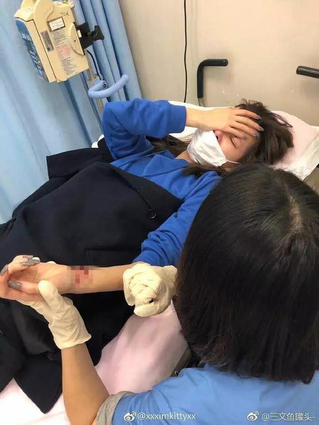 因跟歌手男友分手被指花心，知名网红不堪舆论压力割腕送院！