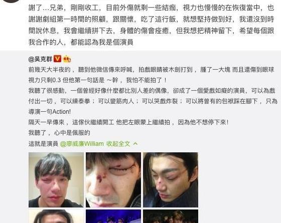 威廉拍戏时眼球遭打伤视力仅剩0。3，吴克群感叹这就是演员