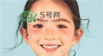 雀斑为什么越来越多?促使雀斑越来越多的原因
