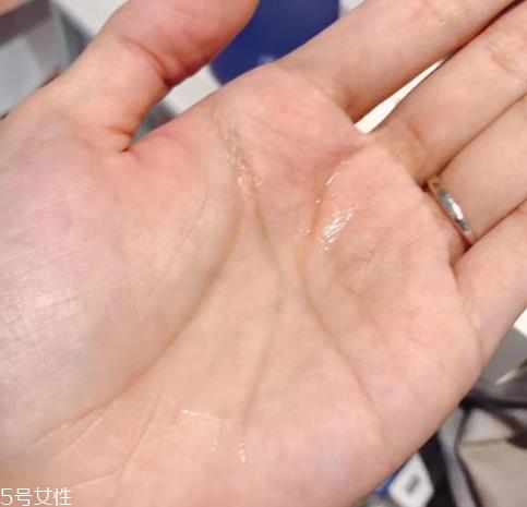 烂脸水是什么意思 烂脸水能祛痘印吗