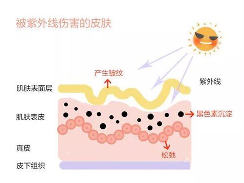 肌肤老化怎么预防最有效 把好这3道关是关键