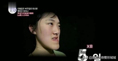 ​中国女孩郭方圆在韩国待了60天，惊艳众人，丑女成功逆袭成女神！