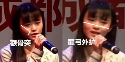 ​鞠婧祎整容史扒皮（一）每一次调整都是精准选择
