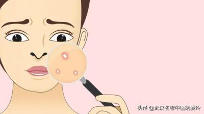 ​毛囊炎感染化脓变成一个大包