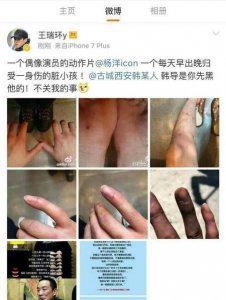 ​杨洋拍戏出意外