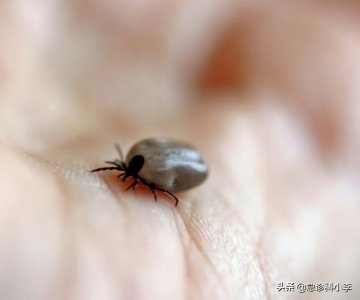 ​被蜱虫咬了有什么症状（“夺命”蜱虫钻人体内吸血，已经致多人死亡，被咬后应