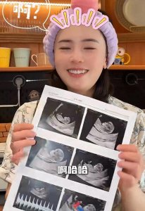 ​田志希晒b超照官宣怀孕，老公徐克因性侵被禁赛十年，她真的超爱