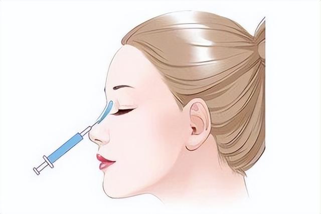 目前哪种隆鼻比较好（市面上的隆鼻技术你都有所了解吗）(2)