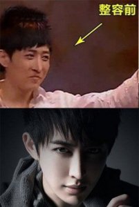 ​魔术师yif整容，yif为什么退(yif为什么退出魔术)