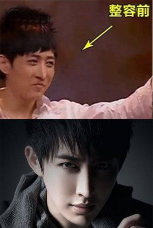 魔术师yif整容，yif为什么退(yif为什么退出魔术)