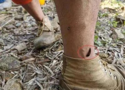 ​如果水蛭被人误入到体内，它是否会对人的身体造成危害呢？