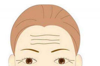 ​什么是抬头纹呢 抬头纹是怎么形成的呢
